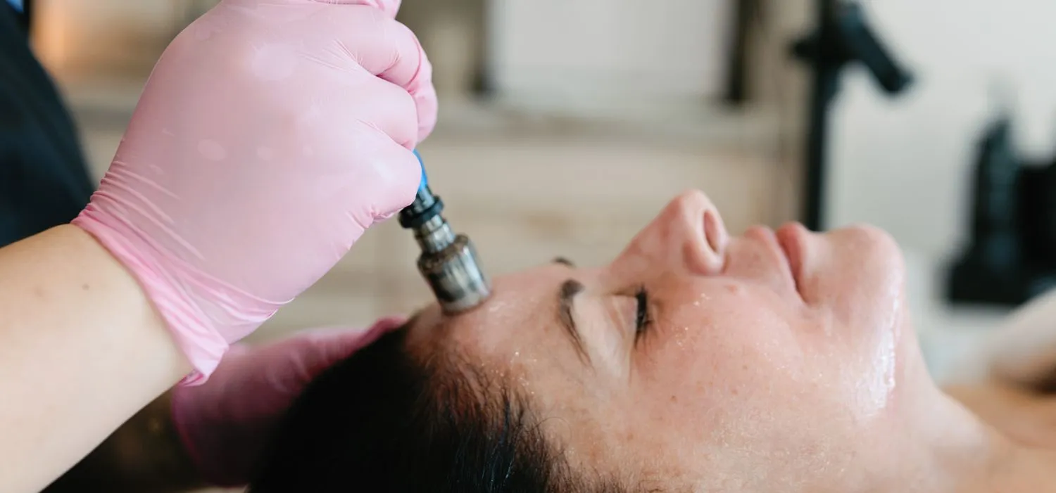 A licensed RAYNĒ provider performing microneedling