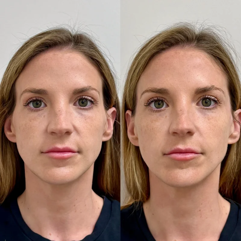 Facetune_27-05-2025-10-31-55