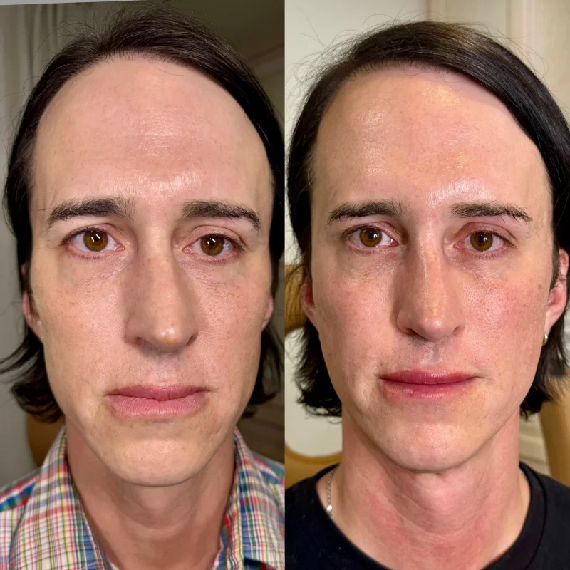 temple_filler_justin